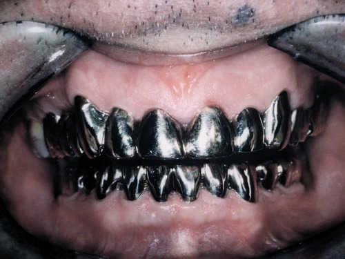 Silver teeth